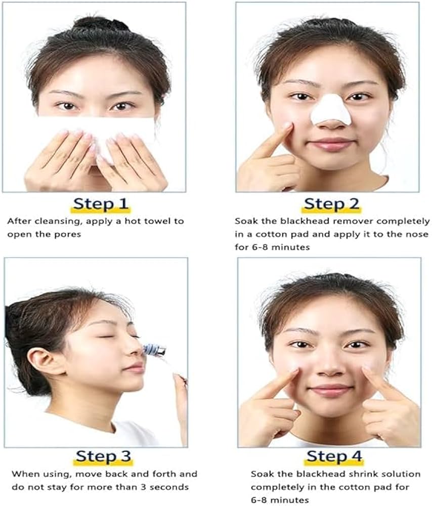 4-in-1 Blackhead Remover Vacuum for Women & Men – Electric Pore Cleaner with 4 Suction Heads, USB Rechargeable Acne Extractor