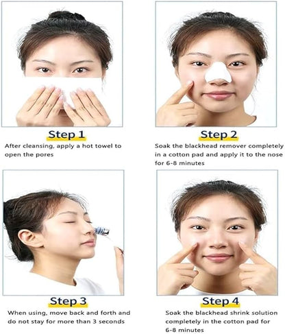 4-in-1 Blackhead Remover Vacuum for Women & Men – Electric Pore Cleaner with 4 Suction Heads, USB Rechargeable Acne Extractor